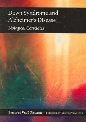 Down Syndrome and Alzheimer's Disease de Vee Prasher