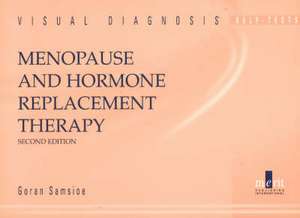 Menopause and Hormone Replacement Therapy de Goran Samsioe