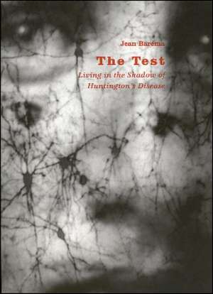 The Test: Living in the Shadow of Huntington's Disease: Living in the Shadow of Huntington's Disease de Jean Barema