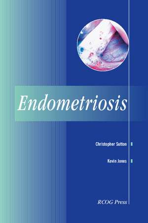 Endometriosis de Christopher Sutton