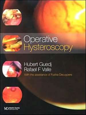 Operative Hysteroscopy de Hubert (University of Paris Guedj