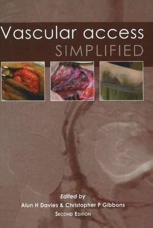 Vascular Access Simplified; Second Edition de Alun H. Davies
