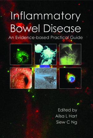 Inflammatory Bowel Disease de Alisa L., BMBCh, MRCP, Ph.D. Hart