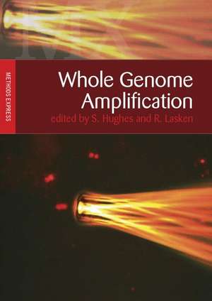 Whole Genome Amplification: Methods Express de Simon Hughes