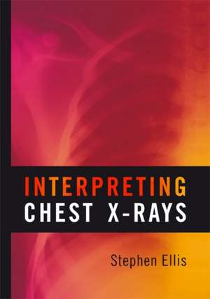 Interpreting Chest X-Rays de Stephen Ellis