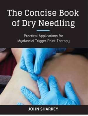 The Concise Book of Dry Needling de John Sharkey