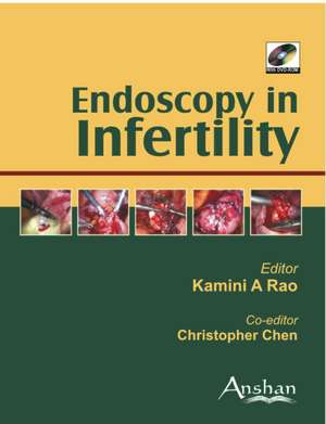 Endoscopy in Infertility with DVD-ROM de Kim Hunter