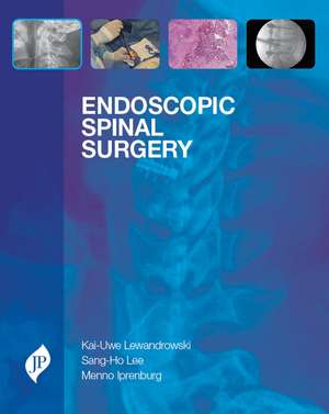 Endoscopic Spinal Surgery de Kai-Uwe Lewandrowski