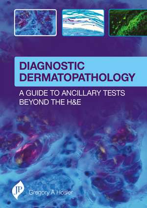 Diagnostic Dermatopathology: A Guide to Ancillary Tests Beyond the H&E de Gregory Hosler