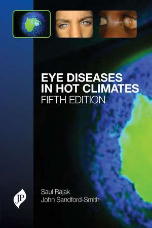 Eye Diseases in Hot Climates de Saul N. Rajak