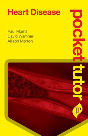 Pocket Tutor Heart Disease de Paul Morris