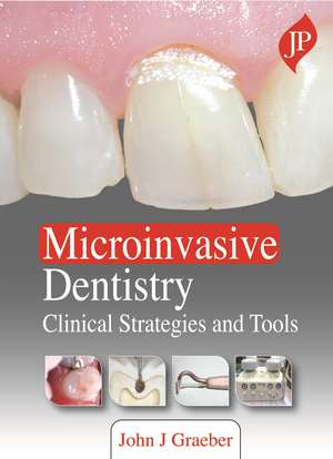 Microinvasive Dentistry: Clinical Strategies and Tools de John J Graeber