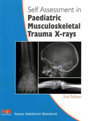 Self-Assessment in Paediatric Musculoskeletal Trauma X-Rays de Karen Sakthivel-Wainford