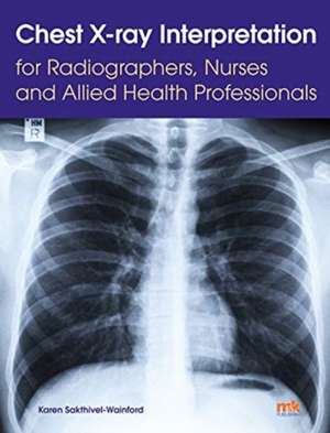 Chest X-ray Interpretation for Radiographers, Nurses and Allied Health Professionals