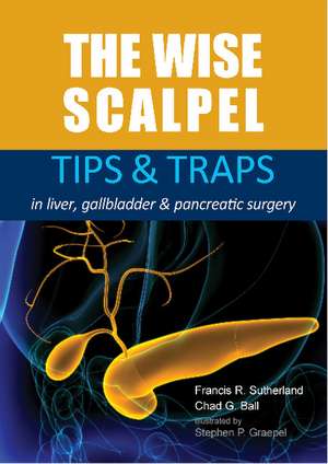 The Wise Scalpel: Tips & Traps in Liver, Gallbladder & Pancreatic Surgery de Dr Francis R. Sutherland MD FRCSC