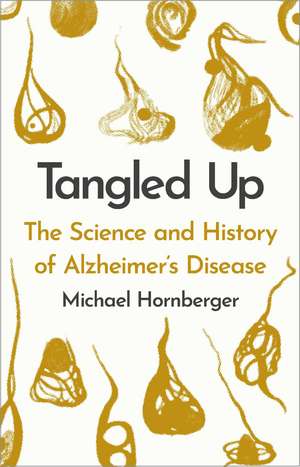 Tangled Up: The History and Science of Alzheimer's Disease de Michael Hornberger