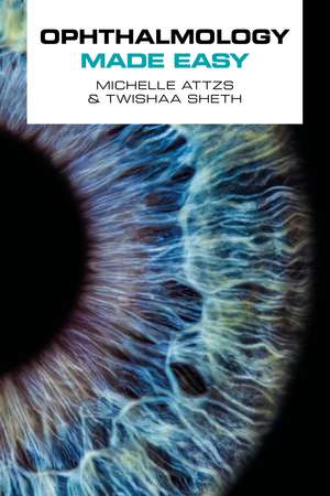 Ophthalmology Made Easy de Michelle Attzs