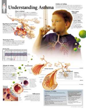 Understanding Asthma Laminated Poster de Scientific Publishing