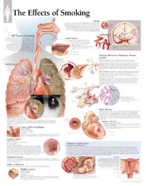 Effects of Smoking Chart: Laminated Wall Chart de Scientific Publishing