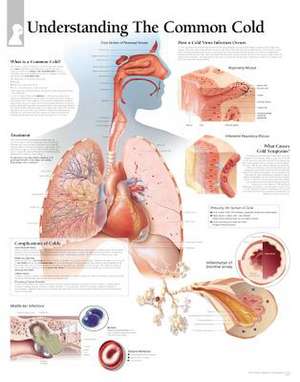 The Common Cold Chart: Wall Chart de various