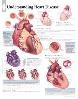 Understanding Heart Disease Chart: Laminated Wall Chart de Scientific Publishing