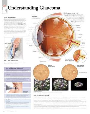 Understanding Glaucoma Laminated Poster de Scientific Publishing