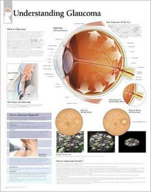 Understanding Glaucoma de Scientific Publishing