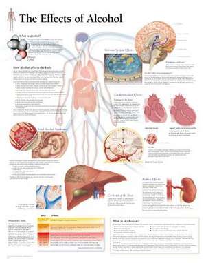 The Effects of Alcohol Chart: Laminated Wall Chart de various