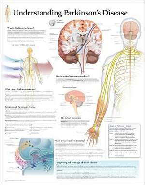 Understanding Parkinson's Chart: Laminated Wall Chart de various