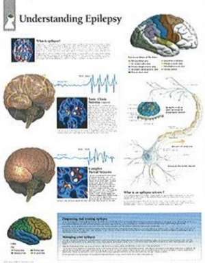 Understanding Epilepsy Chart: Laminated Wall Chart de various