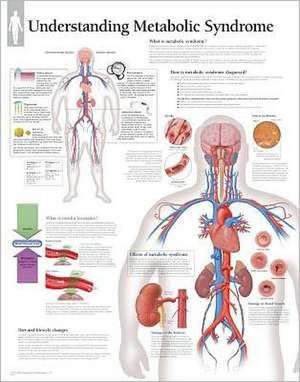 Metabolic Syndrome Chart: Wall Chart de various