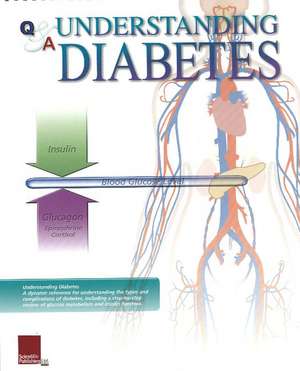 Understanding Diabetes Flip Chart de Scientific Publishing