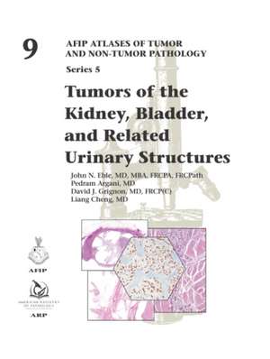 Tumors of the Kidney, Bladder, and Related Urinary Structures de David J. Grignon