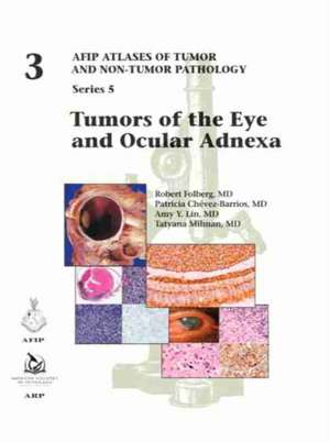 Tumors of the Eye and Ocular Adnexa de Tatyana Millman