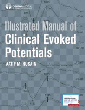 Illustrated Manual of Clinical Evoked Potentials de MD Husain, Aatif M.