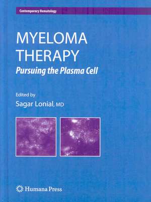 Myeloma Therapy: Pursuing the Plasma Cell de Sagar Lonial