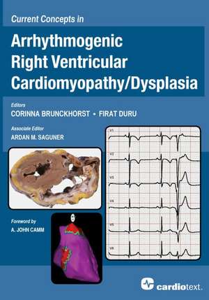 Current Concepts in Arrhythmogenic Right Ventricular Cardiomyopathy / Dysplasia