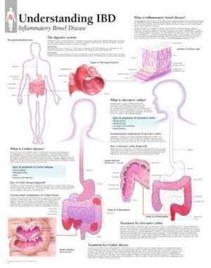 UNDERSTANDING IBD