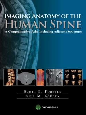 Imaging Anatomy of the Human Spine: A Comprehensive Atlas Including Adjacent Structures de Scott E. Foreseen