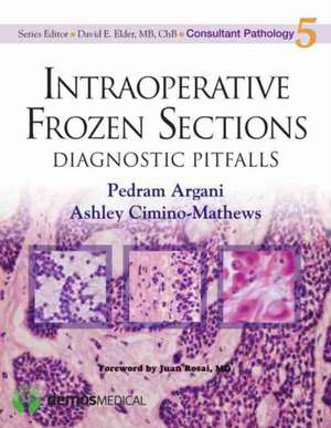 Intraoperative Frozen Sections: Diagnostic Pitfalls de Pedram Argani