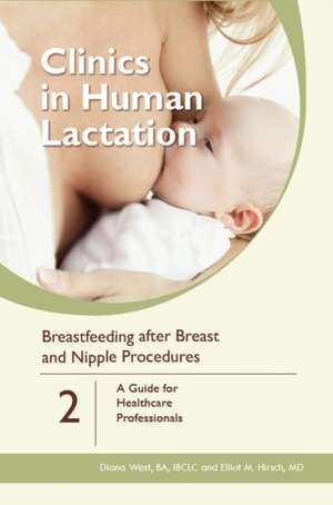 Breastfeeding after Breast and Nipple Procedures: A Guide for Healthcare Professionals de Elliot M. Hirsch