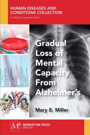 Gradual Loss of Mental Capacity from Alzheimer's de Mary E. Miller