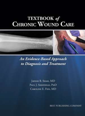 Textbook of Chronic Wound Care de Caroline E Fife