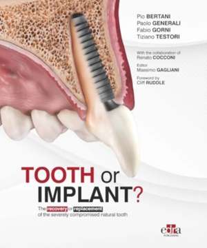 Tooth or Implant de Fabio Gorni