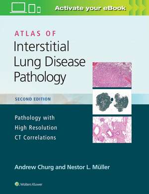 Atlas of Interstitial Lung Disease Pathology de Andrew Churg MD