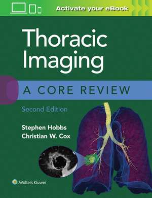 Thoracic Imaging: A Core Review de Stephen Hobbs MD