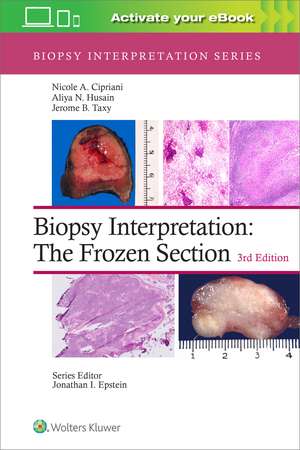 Biopsy Interpretation: The Frozen Section: Print + eBook with Multimedia de Nicole A. Cipriani MD