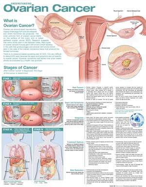 Understanding Ovarian Cancer Anatomical Chart de Anatomical Chart Company