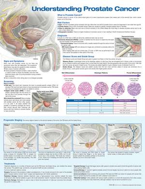 Understanding Prostate Cancer Anatomical Chart de Anatomical Chart Company