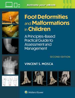 Foot Deformities and Malformations in Children: A Principles-Based, Practical Guide to Assessment and Management: Print + eBook with Multimedia de Vincent Mosca